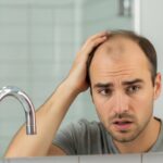 Absolute cure for Male Pattern baldness